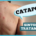 Catapora: sintomas, complicações e prevenção