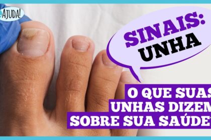 Unhas fracas podem indicar problemas de saúde