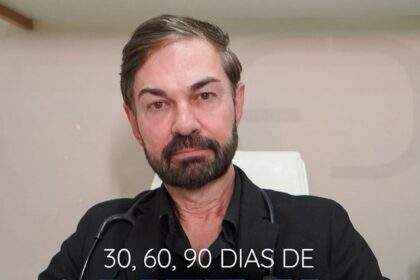 Lift X: o novo queridinho entre os tratamentos faciais promete rejuvenescimento natural em até 90 dias